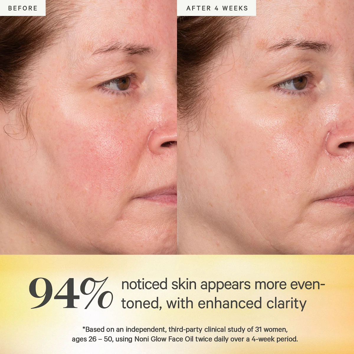 Noni Glow Face Oil - Image 4