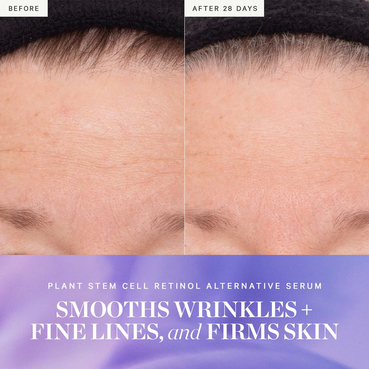 Plant Stem Cell Retinol Alternative Serum - Image 3